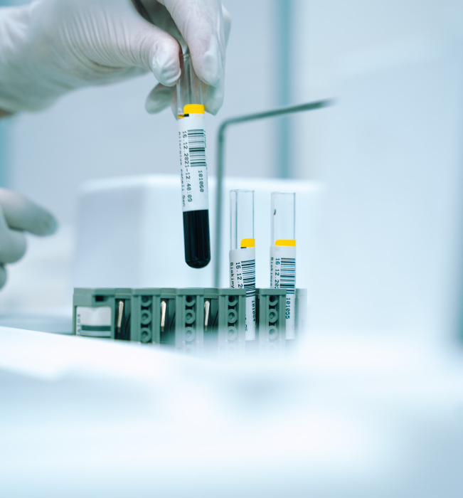 Test tubes in the lab