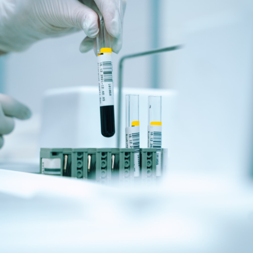 Durch unsere jahrzehntelange<br />
Erfahrung und ausgezeichneten Geschäftsbeziehungen zu deutschen Pharmaherstellern können wir sie bestmöglich bei der Beschaffung unterstützen.  Reagenzgläser im Labor